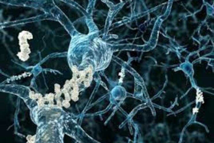 The FDA is set to approve the Alzheimer’s treatment lecanemab.